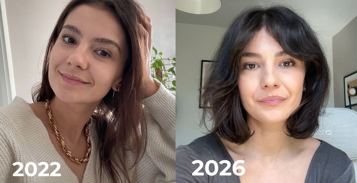 Nobody warns you about the hair you lose — The Sync Way